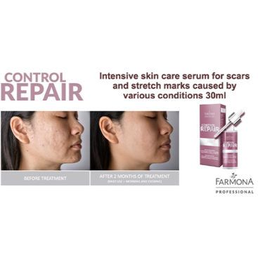 Professional beauty treatment improving skin imperfections.